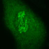 Mitotic Patterns - Biomarker.org Novel Biomarker Discovery